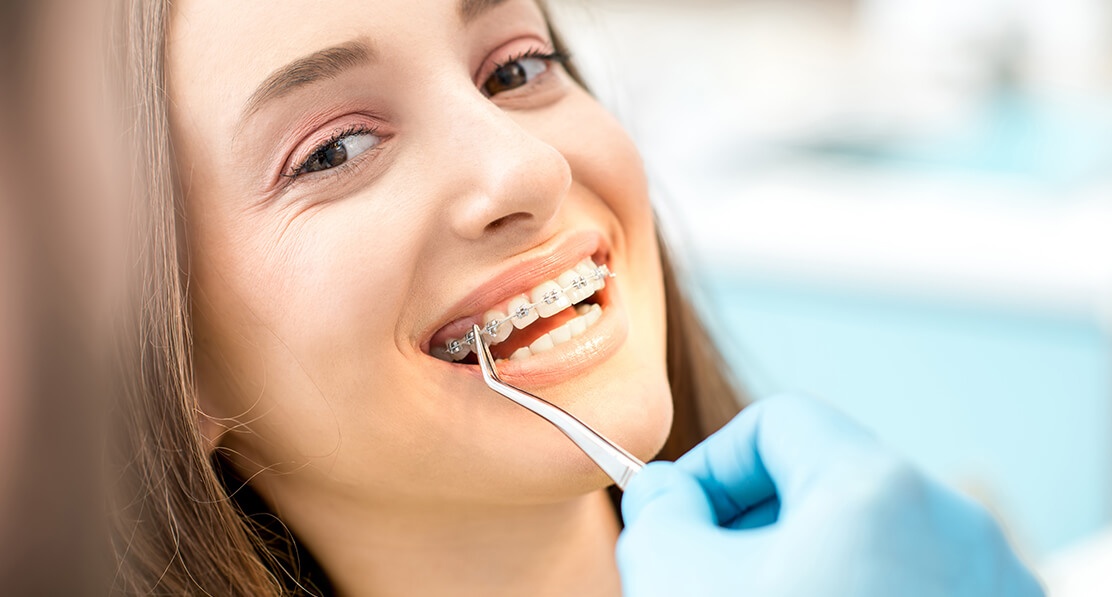 Teeth Whitening Service at Houston