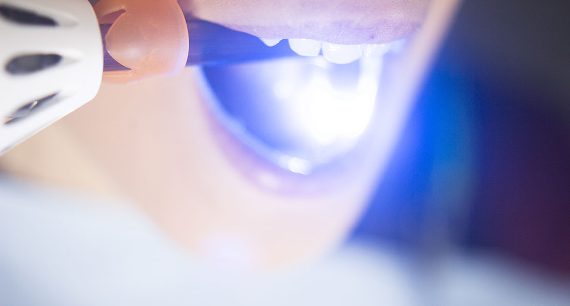 Cosmetic Dentistry